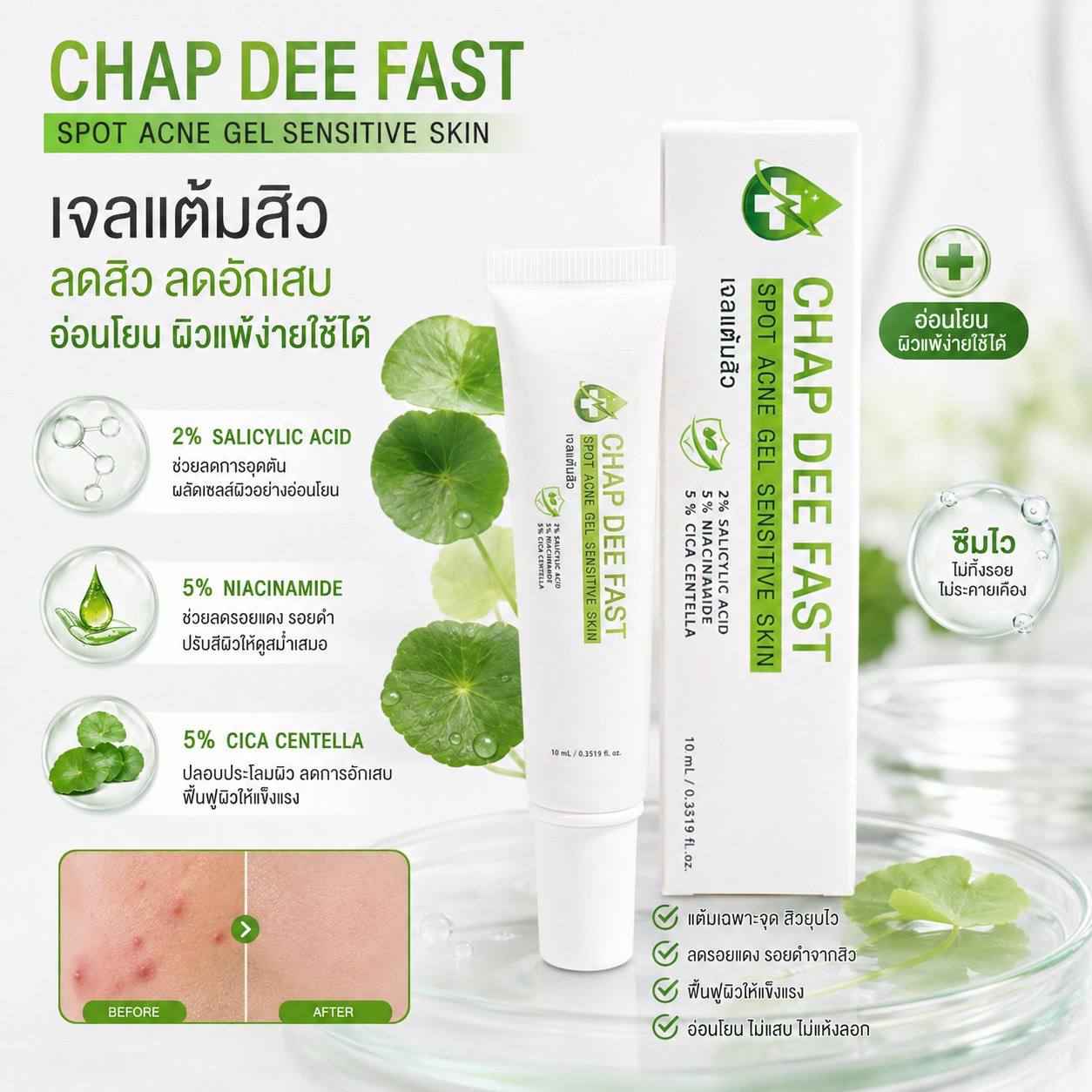CHAP DEE FAST เจลแต้มสิวสำหรับผิวแพ้ง่าย พร้อมสารสำคัญ 3 ชนิด